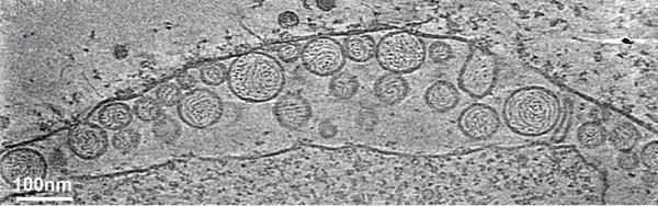 Pictured is a cryo-electron tomography image of a mitochondrion associated with virus RNA replication spherules. 