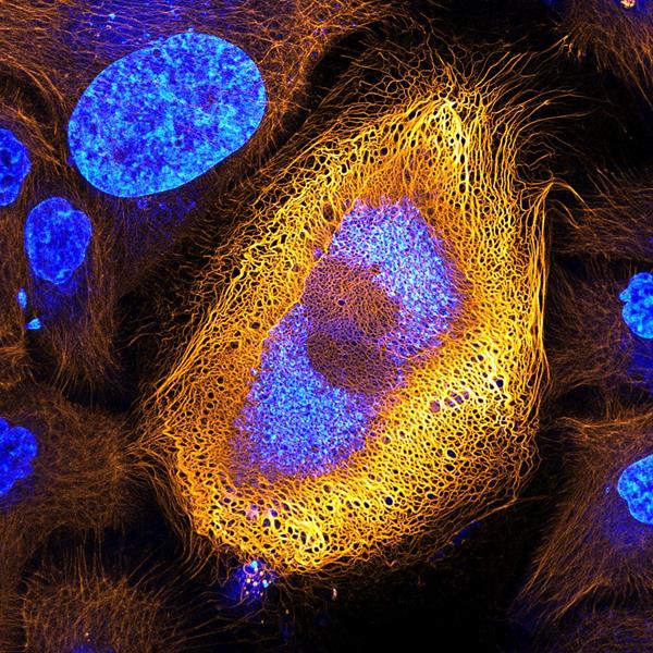 Immortalized human skin cells (HaCaT keratinocytes) expressing fluorescently tagged keratin