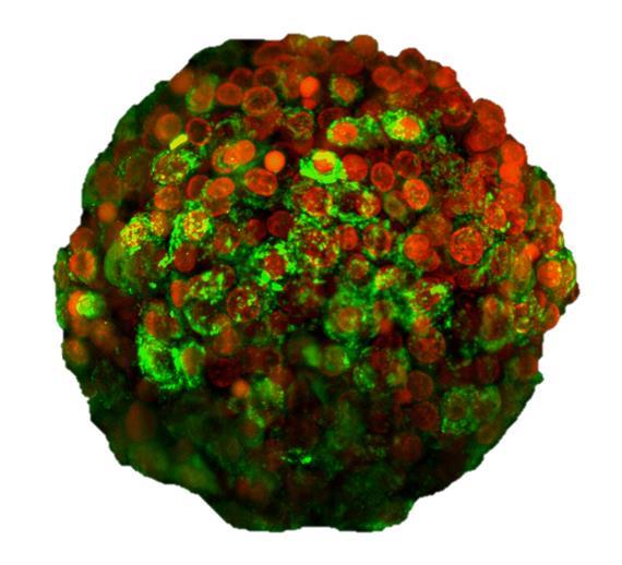 InSphero 3D InSight™ Liver Microtissues help drug discovery and development groups predict drug-induced liver injury (DILI) with greater confidence, providing more relevant and reliable 3-dimensional cell based models for in vitro drug safety testing.