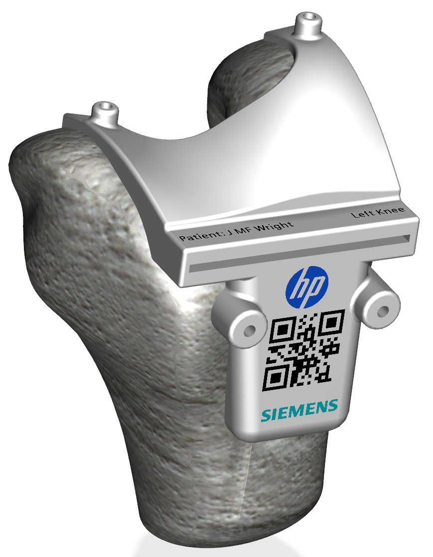 Siemens and HP Color 3D Printed Surgical Cutting Guide