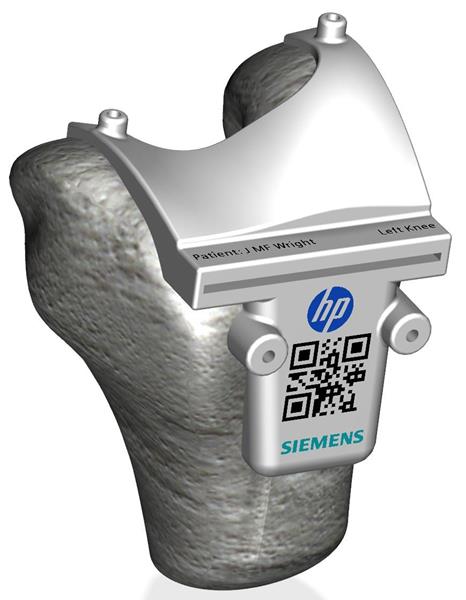 Color 3D printed surgical guide made possible by Siemens design software and HP Multi Jet Fusion.