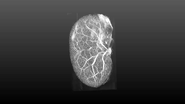 3D digital reconstruction of a Murine Kidney leveraging previous generation scanning technology. 