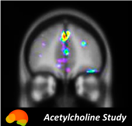 BrainHQ_Acetylcholine_Study_logo.png