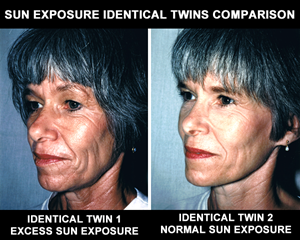 Identical Twins Aging Study