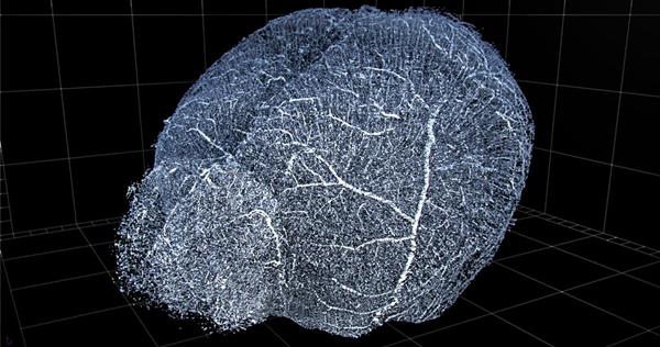 3D rendering of a whole mouse brain vasculature by 3Scan