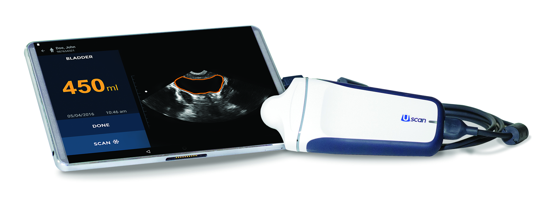 Signostics’ Uscan intelligent ultrasound tool